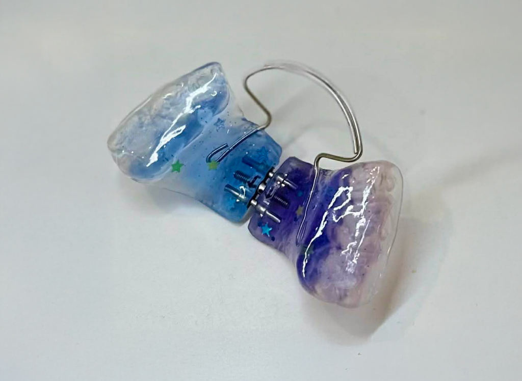 特許取得の小児矯正装置「イージーエキスパンダー」 名古屋の歯科が上下顎拡大に新提案