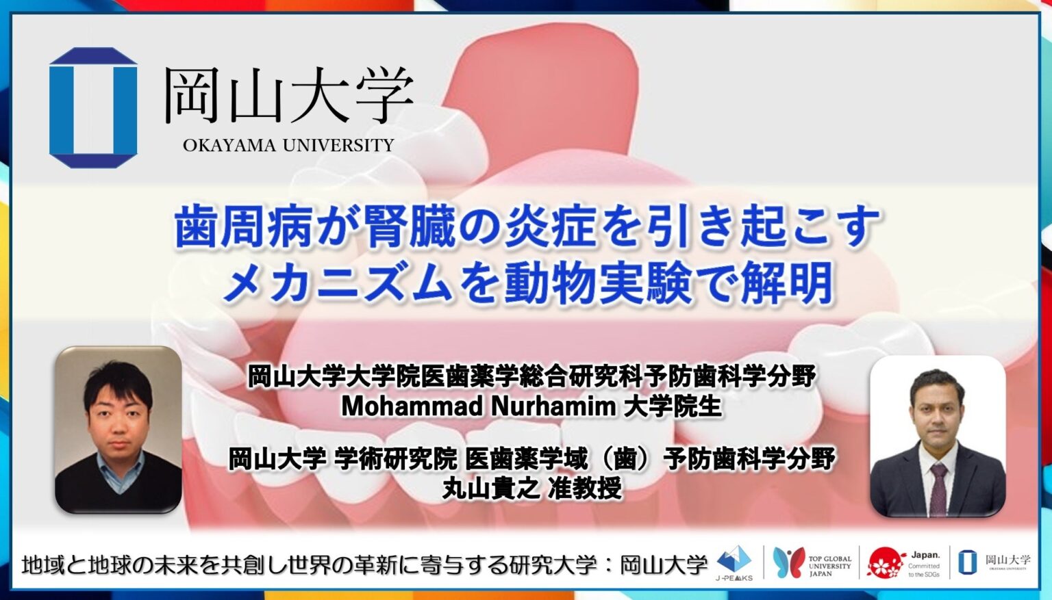 歯周病で増えたmicroRNAが腎臓炎症を誘発 岡山大がラットで経路解明