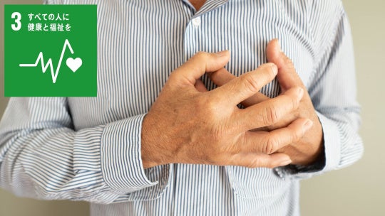 脳梗塞既往の心房細動患者、アブレーション追加でも主要転帰は改善せず 45施設RCT