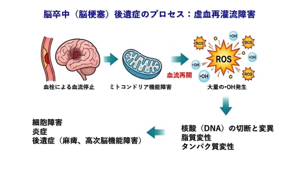 低濃度水素吸入、脳梗塞後遺症の改善可能性を提示 急性期200人研究と爆発リスクを踏まえ注意喚起