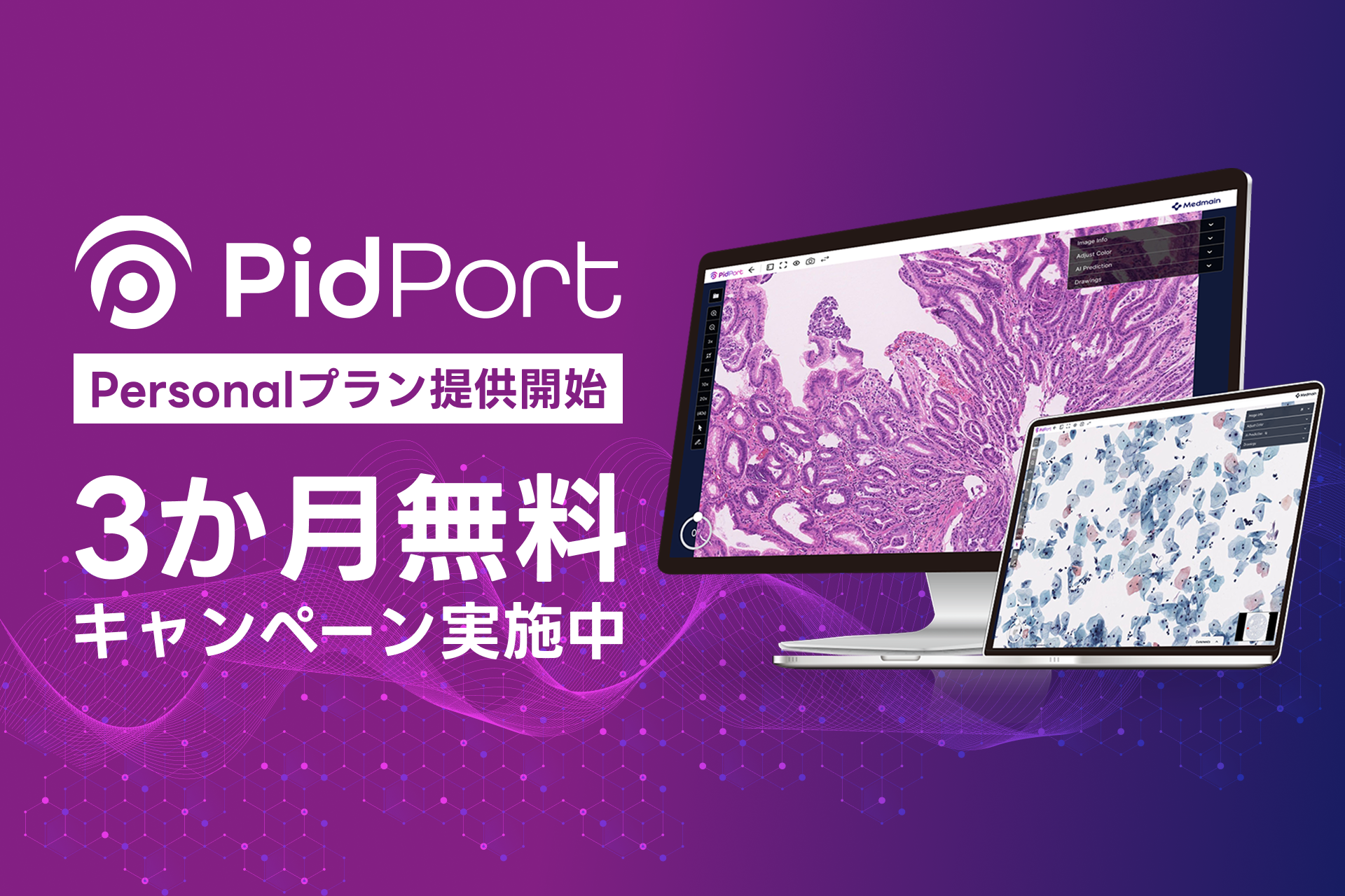 メドメイン、病理画像クラウド「PidPort」を個人向け提供　新規は3か月無料に